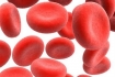 How to treat iron deficiency anemia?